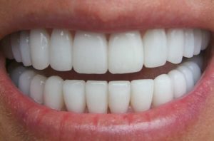 showing clean teeth